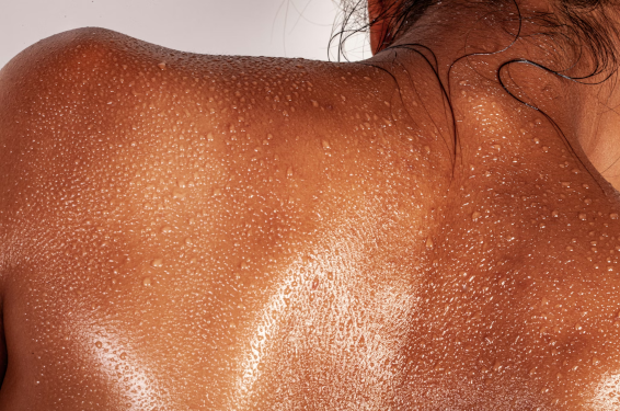 Dieta vegana y piel: cómo puede mejorar acné, dermatitis y psoriasis